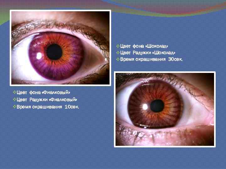 v. Цвет фона «Шоколад» v. Цвет Радужки «Шоколад» v. Время окрашивания 30 сек. v.