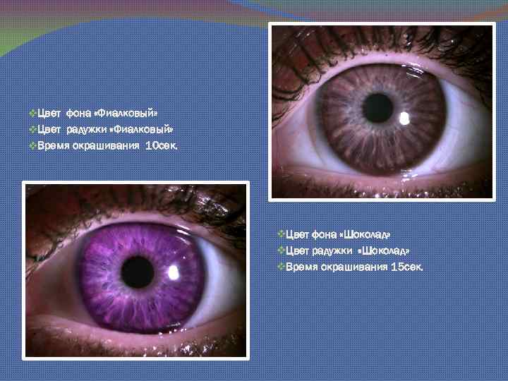 v. Цвет фона «Фиалковый» v. Цвет радужки «Фиалковый» v. Время окрашивания 10 сек. v.