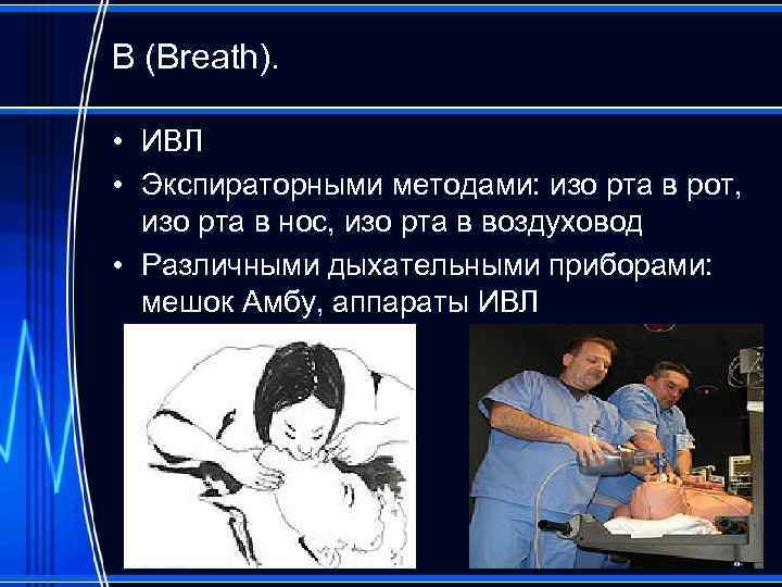 В (Breath). • ИВЛ • Экспираторными методами: изо рта в рот, изо рта в