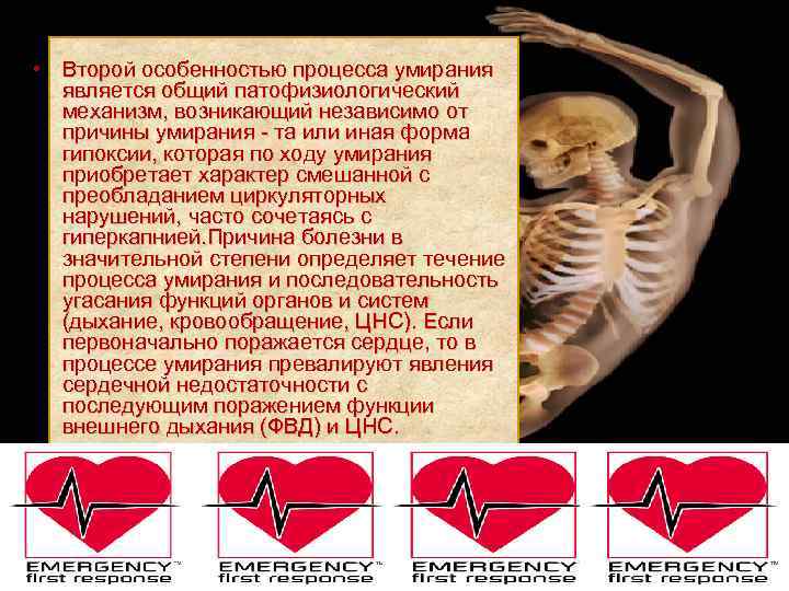  • Второй особенностью процесса умирания является общий патофизиологический механизм, возникающий независимо от причины