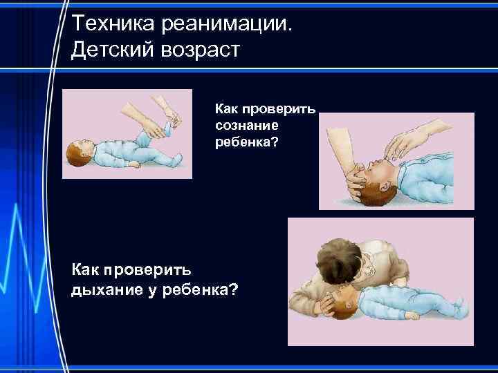 Техника реанимации. Детский возраст Как проверить сознание ребенка? Как проверить дыхание у ребенка? 