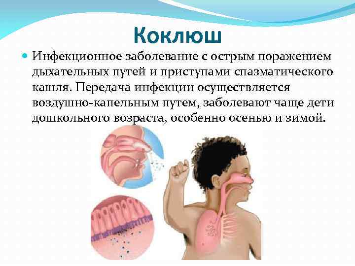 Коклюш Инфекционное заболевание с острым поражением дыхательных путей и приступами спазматического кашля. Передача инфекции