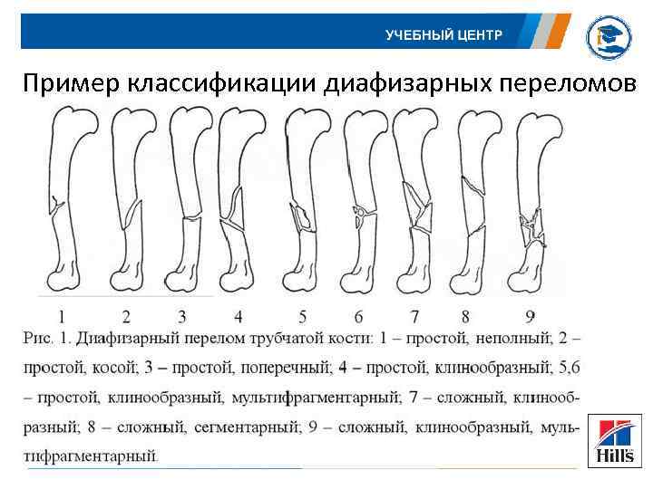 Схема колесникова травматология