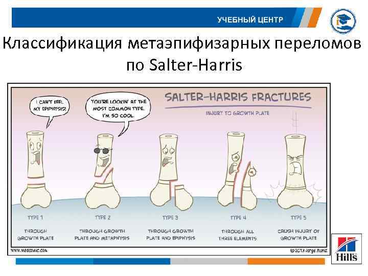 Классификация метаэпифизарных переломов по Salter-Harris 