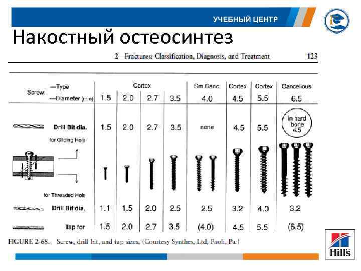 Накостный остеосинтез 