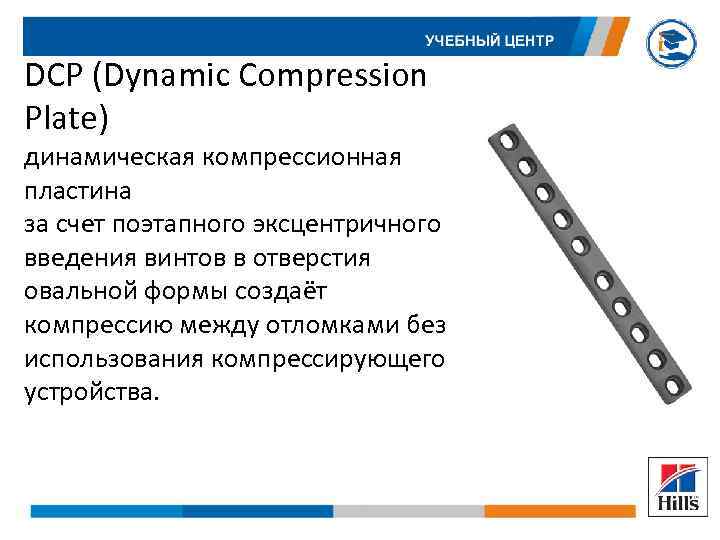 DCP (Dynamic Compression Plate) динамическая компрессионная пластина за счет поэтапного эксцентричного введения винтов в