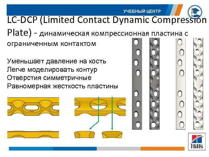 LC-DCP (Limited Contact Dynamic Compression Plate) - динамическая компрессионная пластина c ограниченным контактом Уменьшает