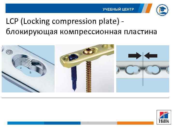 LCP (Locking compression plate) блокирующая компрессионная пластина 