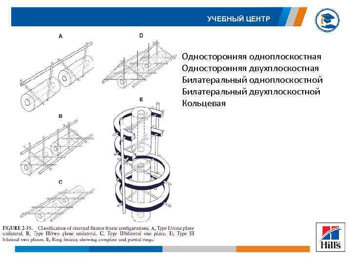 Односторонняя одноплоскостная Односторонняя двухплоскостная Билатеральный одноплоскостной Билатеральный двухплоскостной Кольцевая 