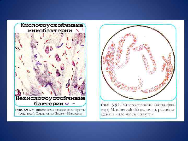 Кислотоустойчивые микобактерии. Микобактерии туберкулеза микробиология. Морфология туберкулеза. Возбудитель туберкулеза микробиология. Микобактерии микробиология морфология.