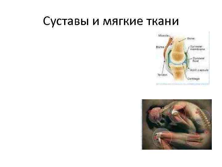 Суставы и мягкие ткани 