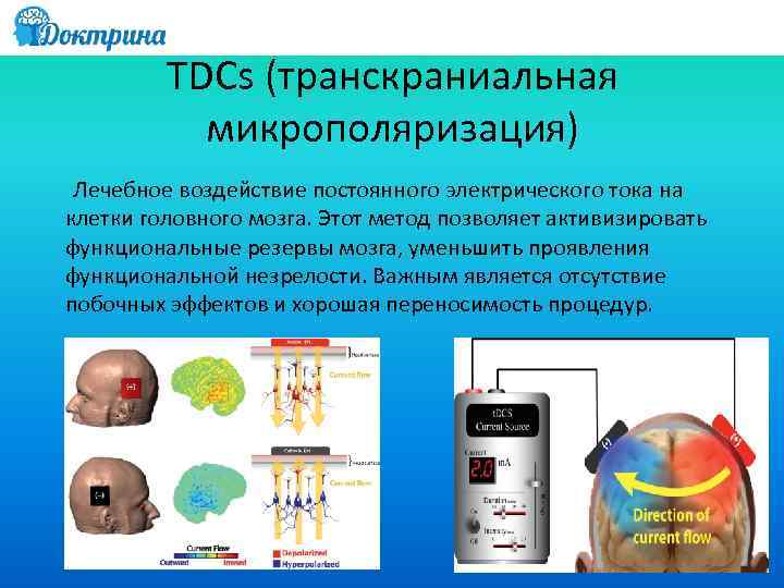 TDCs (транскраниальная микрополяризация) Лечебное воздействие постоянного электрического тока на клетки головного мозга. Этот метод