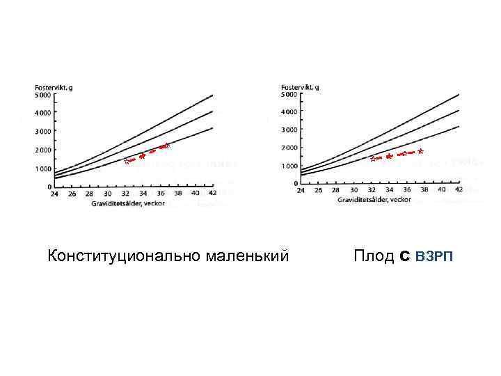 Конституционально маленький Плод с ВЗРП 