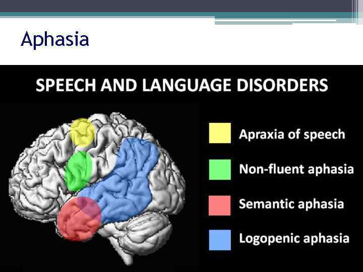 Aphasia 