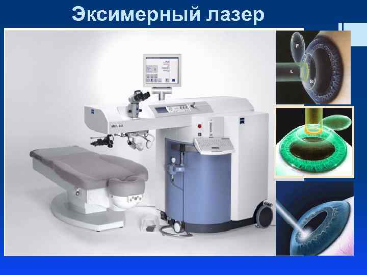 Эксимерный лазер 