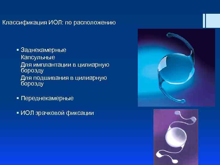 Классификация ИОЛ: по расположению § Заднекамерные Капсульные Для имплантации в цилиарную борозду Для подшивания