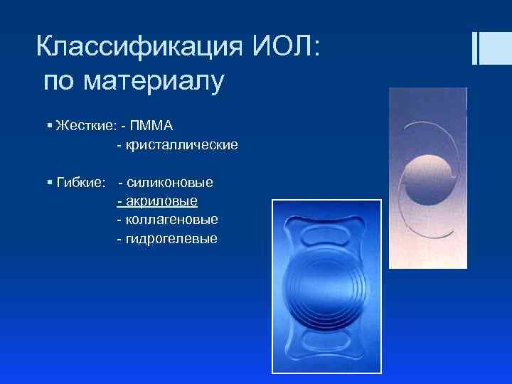 Классификация ИОЛ: по материалу § Жесткие: - ПММА - кристаллические § Гибкие: - силиконовые