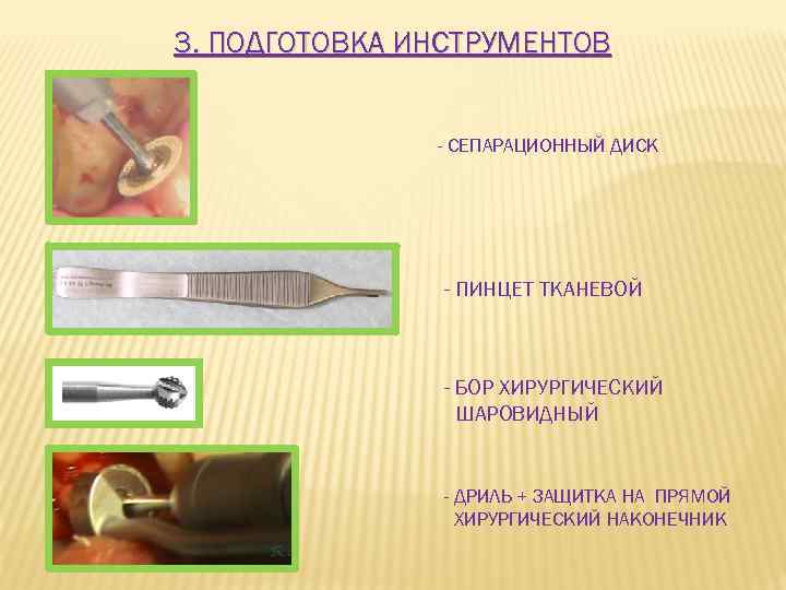 3. ПОДГОТОВКА ИНСТРУМЕНТОВ - СЕПАРАЦИОННЫЙ ДИСК - ПИНЦЕТ ТКАНЕВОЙ - БОР ХИРУРГИЧЕСКИЙ ШАРОВИДНЫЙ -