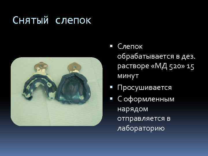 Снятый слепок Слепок обрабатывается в дез. растворе «МД 520» 15 минут Просушивается С оформленным