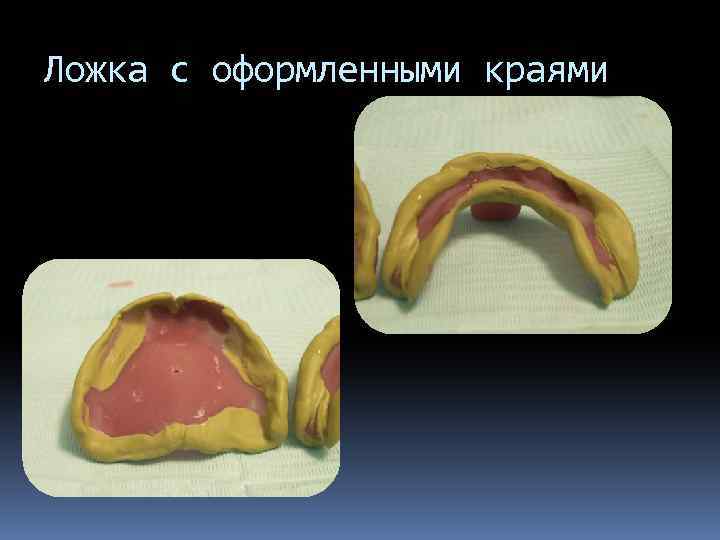 Ложка с оформленными краями 