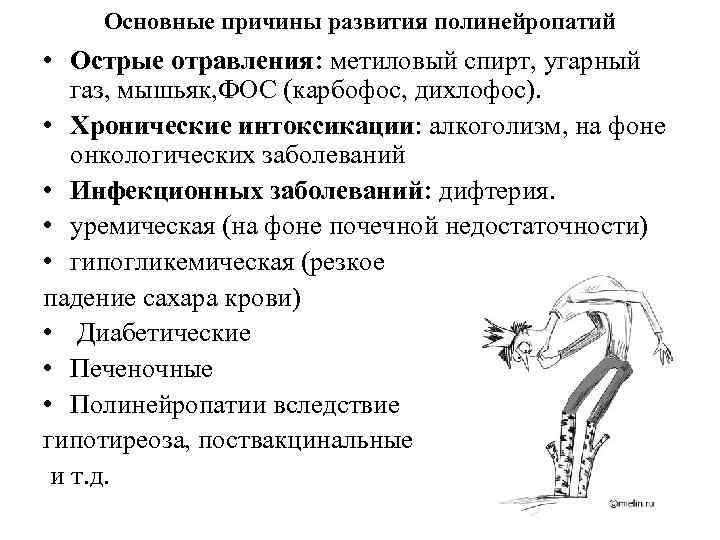 Отравление метиловым спиртом презентация