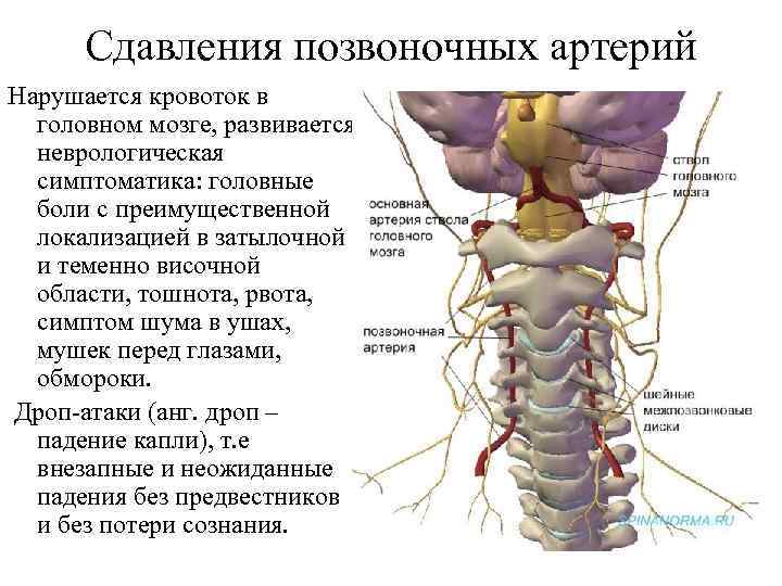 Заболевания периферической нервной системы презентация