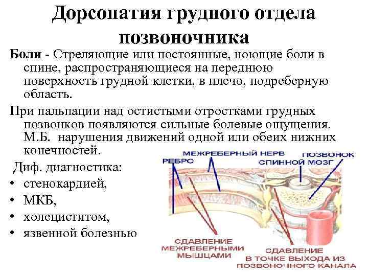 Дорсопатия грудного отдела позвоночника карта вызова