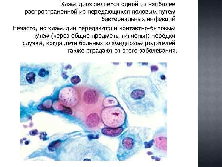 Хламидиоз является одной из наиболее распространенной из передающихся половым путем бактериальных инфекций Нечасто, но