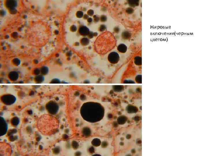 Жировые включения(черным цветом) 