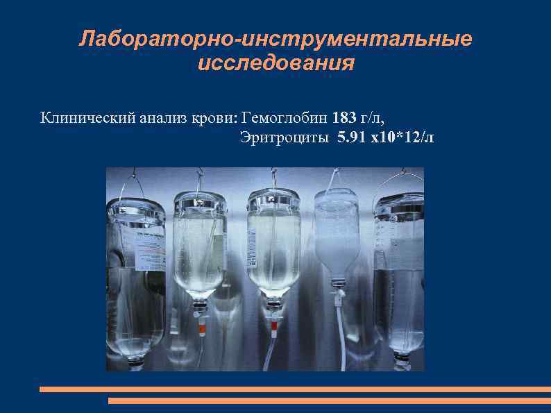 Лабораторно-инструментальные исследования Клинический анализ крови: Гемоглобин 183 г/л, Эритроциты 5. 91 x 10*12/л 