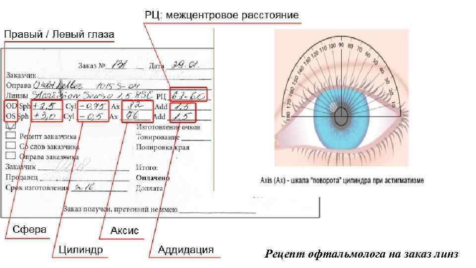 Сокращение OD и OS – краткие обозначения латинской терминологии «oculus dexter» , «oculus sinister»