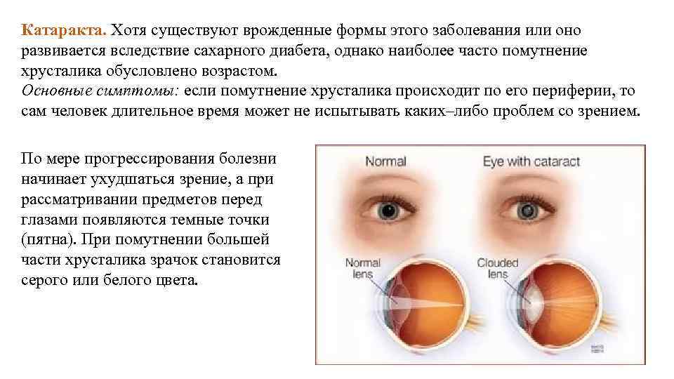 Презентация на тему гигиена зрения предупреждение глазных болезней