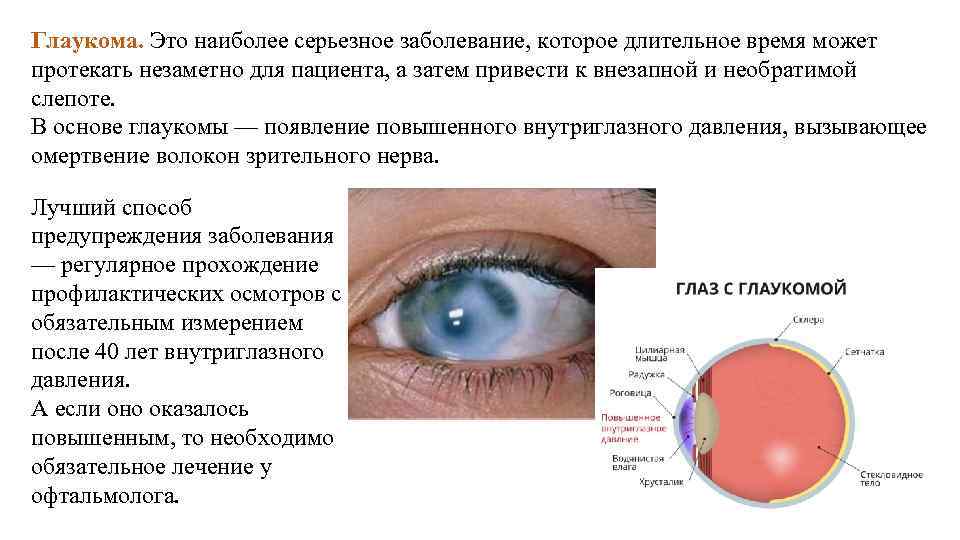 Ячмень презентация офтальмология