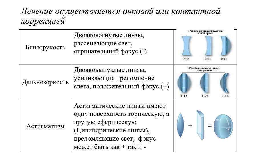 Лечение осуществляется очковой или контактной коррекцией Близорукость Двояковогнутые линзы, рассеивающие свет, отрицательный фокус (-)