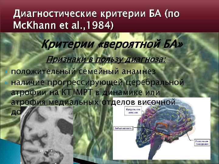 Диагностические критерии БА (по Mc. Khann et al. , 1984) Критерии «вероятной БА» Признаки