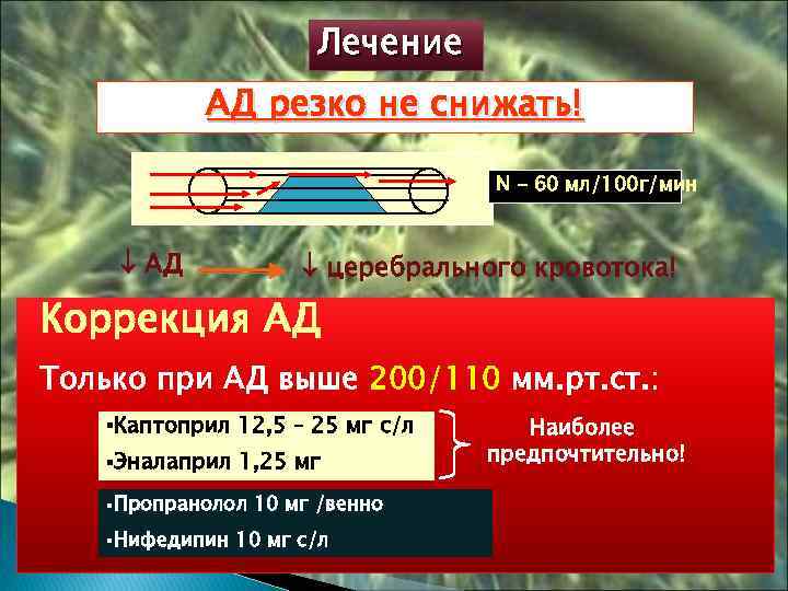 Лечение АД резко не снижать! N - 60 мл/100 г/мин АД церебрального кровотока! Коррекция