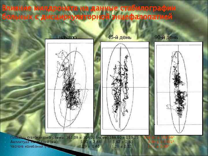 Влияние милдроната на данные стабилографии больных с дисциркуляторной энцефалопатией начало 45 -й день Площадь