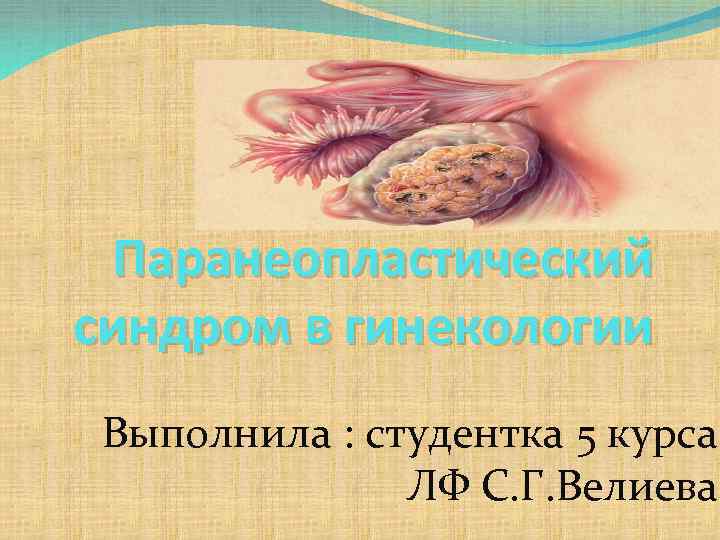 Паранеопластический синдром в гинекологии Выполнила : студентка 5 курса ЛФ С. Г. Велиева 