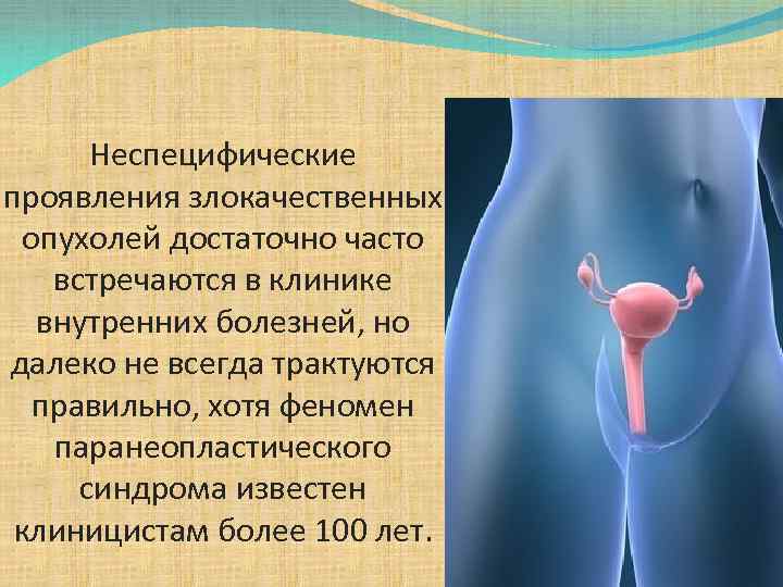 Неспецифические проявления злокачественных опухолей достаточно часто встречаются в клинике внутренних болезней, но далеко не