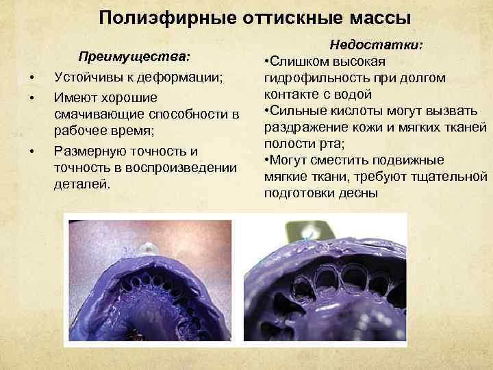 Полиэфирные оттискные массы • • • Преимущества: Устойчивы к деформации; Имеют хорошие смачивающие способности