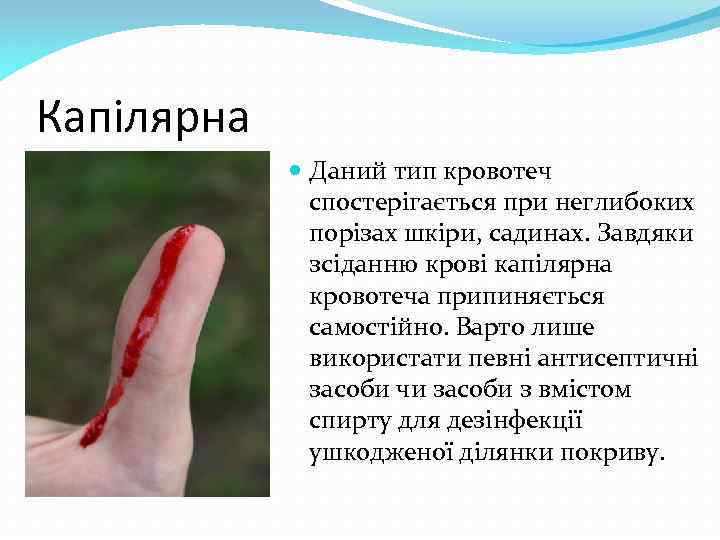 Капілярна Даний тип кровотеч спостерігається при неглибоких порізах шкіри, садинах. Завдяки зсіданню крові капілярна