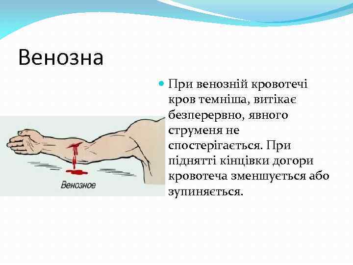 Венозна При венозній кровотечі кров темніша, витікає безперервно, явного струменя не спостерігається. При піднятті