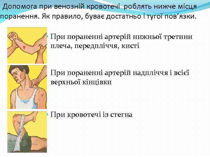 Допомога при венозній кровотечі роблять нижче місця поранення. Як правило, буває достатньо і тугої