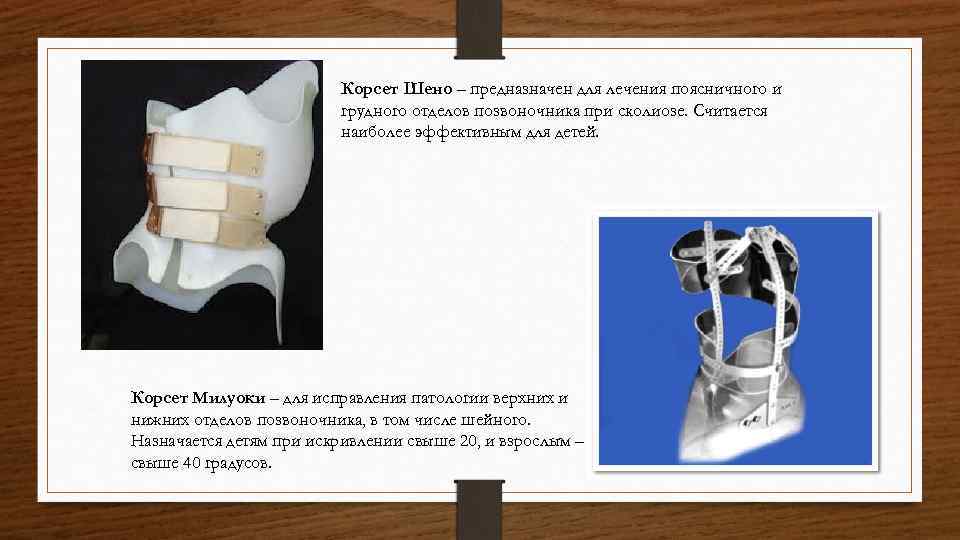 Корсет Шено – предназначен для лечения поясничного и грудного отделов позвоночника при сколиозе. Считается