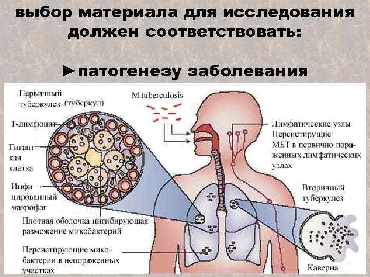 выбор материала для исследования должен соответствовать: ►патогенезу заболевания 