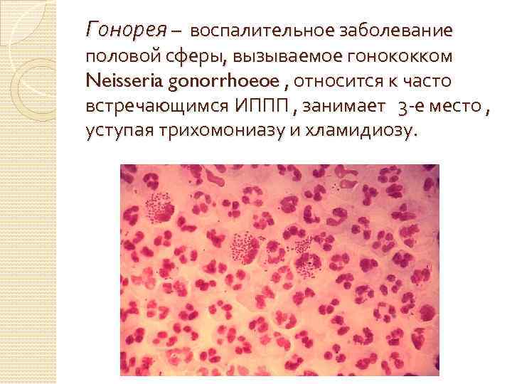 Гонорея – воспалительное заболевание половой сферы, вызываемое гонококком Neisseria gonorrhoeoe , относится к часто