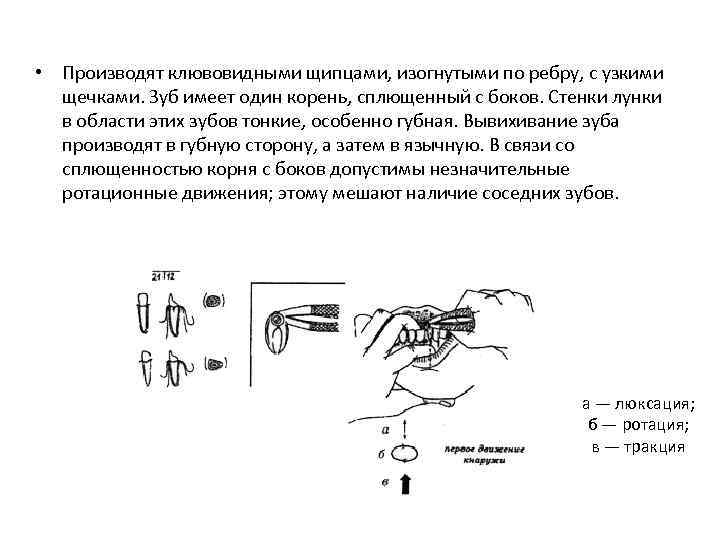  • Производят клювовидными щипцами, изогнутыми по ребру, с узкими щечками. Зуб имеет один