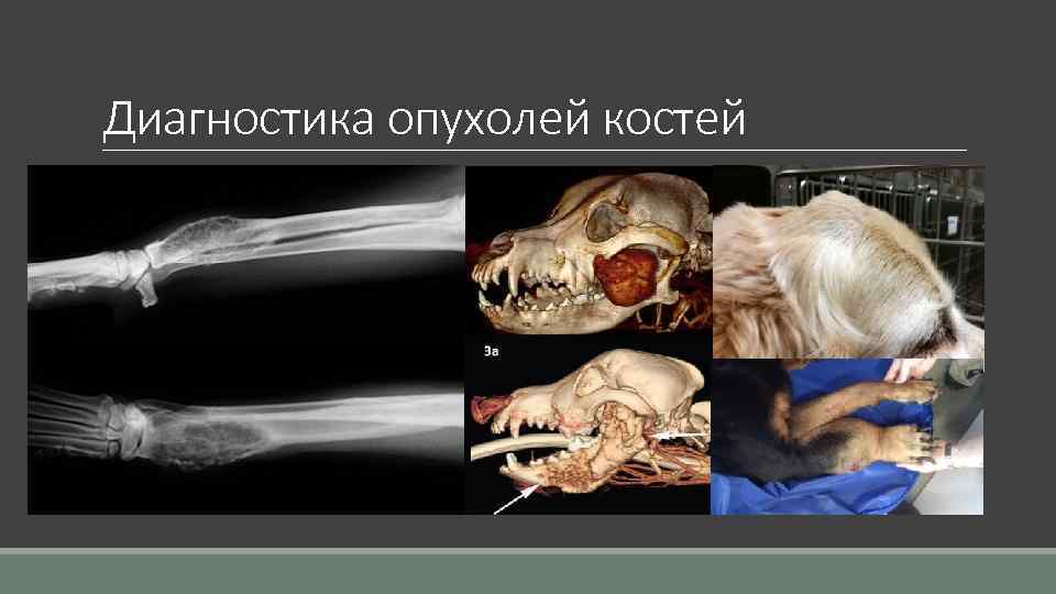Диагностика опухолей костей 