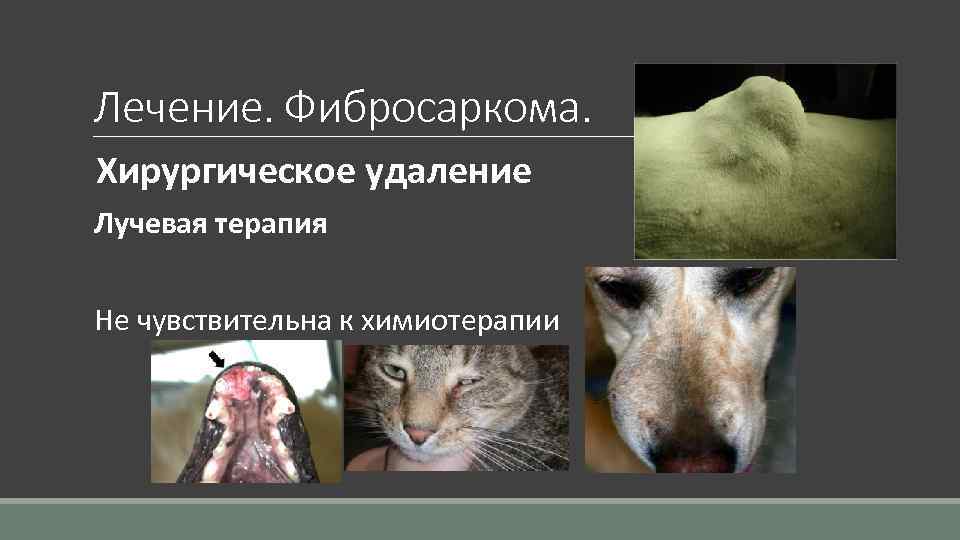 Лечение. Фибросаркома. Хирургическое удаление Лучевая терапия Не чувствительна к химиотерапии 