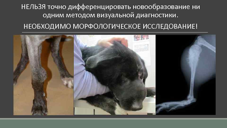  НЕЛЬЗЯ точно дифференцировать новообразование ни одним методом визуальной диагностики. НЕОБХОДИМО МОРФОЛОГИЧЕСКОЕ ИССЛЕДОВАНИЕ! 